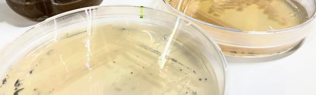 Kulturen von harmlosen Bakterien, wie sie auch im menschlichen Darm vorkommen.