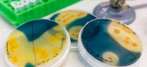 Verfahren zum Nachweis von Bakterienkulturen