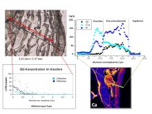 Implantat Images